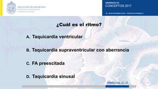 URGENCIA UC
CONCEPTOS 2017
28 – 30 DE SEPTIEMBRE DE 2017 – CENTRO DE EXTENSIÓN UC
medicina.uc.cl
¿Cuál es el ritmo?
A. Taquicardia ventricular
B. Taquicardia supraventricular con aberrancia
C. FA preexcitada
D. Taquicardia sinusal
 