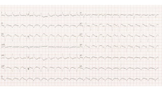 XII CURSO ANUAL DE POSTGRADO
Toma de decisiones e Cardiología y
Cirugía Cardiovascular
 