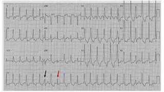 XII CURSO ANUAL DE POSTGRADO
Toma de decisiones e Cardiología y
Cirugía Cardiovascular
 