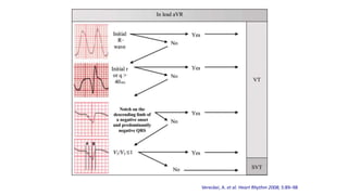 Vereckei, A. et al. Heart Rhythm 2008; 5:89–98
 