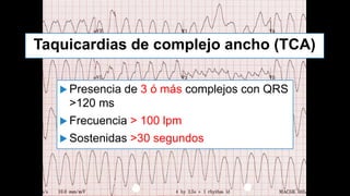Taquicardias de complejo ancho (TCA)
 Presencia de 3 ó más complejos con QRS
>120 ms
 Frecuencia > 100 lpm
 Sostenidas >30 segundos
 