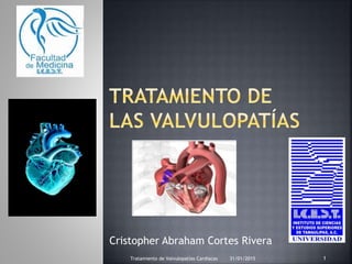 Cristopher Abraham Cortes Rivera
31/01/2015 1Tratamiento de Valvulopatías Cardiacas
 