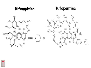 Tratamiento de la tuberculosis