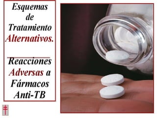 Tratamiento de la tuberculosis