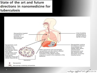 Tratamiento de la tuberculosis  final