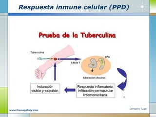 Respuesta inmune celular (PPD)
Company Logo
www.themegallery.com
 