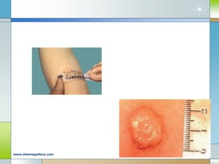 Company Logo
www.themegallery.com
 