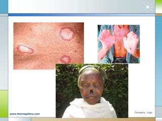 Company Logo
www.themegallery.com
 