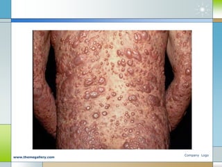 Company Logo
www.themegallery.com
 