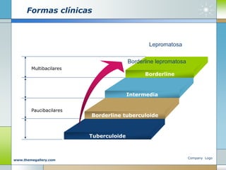 Company Logo
www.themegallery.com
Formas clínicas
Multibacilares
Paucibacilares
Borderline lepromatosa
Borderline
Intermedia
Borderline tuberculoide
Tuberculoide
Lepromatosa
 