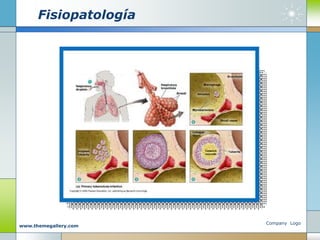 Fisiopatología
Company Logo
www.themegallery.com
 