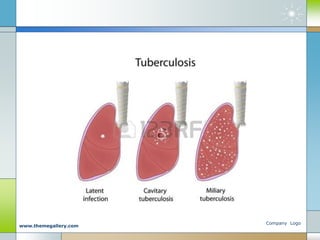 Company Logo
www.themegallery.com
 