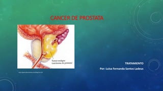 CANCER DE PROSTATA

TRATAMIENTO
Por: Luisa Fernanda Santos Ladeus
http://ganocafecolombia.com/blog/?p=274

 