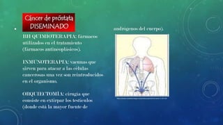 •

andrógenos del cuerpo).

BH QUIMIOTERAPIA: fármacos
utilizados en el tratamiento
(fármacos antineoplásicos).
INMUNOTERAPIA: vacunas que
sirven para atacar a las células
cancerosas una vez son reintroducidos
en el organismo.

ORQUIECTOMÍA: cirugía que
consiste en extirpar los testículos
(donde está la mayor fuente de

http://www.unidadurologia.es/portaluu/portal?content=1:33:134

 