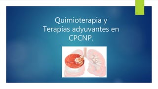Quimioterapia y
Terapias adyuvantes en
CPCNP.
 