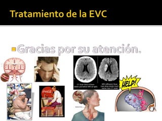Tratamiento de la EVCGracias por su atención.