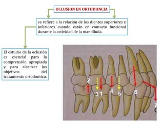 OCLUSION EN ORTODONCIA


                   se refiere a la relación de los dientes superiores e
                   inferiores cuando están en contacto funcional
                   durante la actividad de la mandíbula.



El estudio de la oclusión
es esencial para la
comprensión apropiada
y para alcanzar los
objetivos             del
tratamiento ortodontico.
 