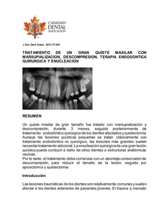 J Can Dent Assoc 2011;77:b87
TRATAMIENTO DE UN GRAN QUISTE MAXILAR CON
MARSUPIALIZACION, DESCOMPRESION, TERAPIA ENDODONTICA
QUIRURGICA Y ENUCLEACION
RESUMEN
Un quiste maxilar de gran tamaño fue tratado con marsupialización y
descompresión, durante 3 meses, seguido posteriormente de
tratamiento endodóntico quirúrgico de los dientes afectados yquistectomia.
Aunque las lesiones quísticas pequeñas se tratan clásicamente con
tratamiento endodóntico no quirúrgico, las lesiones más grandes suelen
necesitartratamiento adicional. La enucleaciónquirúrgicade una gran lesión
quística puede conducir a daño de otros dientes o estructuras anatómicas
vecinas.
Por lo tanto, el tratamiento debe comenzar con un abordaje conservadorde
descompresión, para reducir el tamaño de la lesión, seguido por
apicectomía y quistectomia.
Introducción
Las lesiones traumáticas de los dientes sonrelativamente comunes ysuelen
afectar a los dientes anteriores de pacientes jóvenes. El trauma a menudo
 