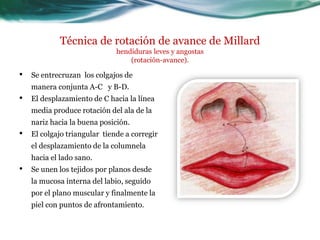 Técnica de rotación de avance de Millard
                              hendiduras leves y angostas
                                  (rotación-avance).

•   Se entrecruzan los colgajos de
    manera conjunta A-C y B-D.
•   El desplazamiento de C hacia la línea
    media produce rotación del ala de la
    nariz hacia la buena posición.
•   El colgajo triangular tiende a corregir
    el desplazamiento de la columnela
    hacia el lado sano.
•   Se unen los tejidos por planos desde
    la mucosa interna del labio, seguido
    por el plano muscular y finalmente la
    piel con puntos de afrontamiento.
 