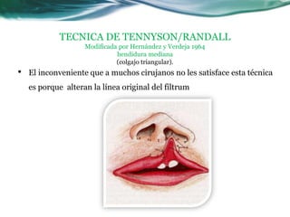 TECNICA DE TENNYSON/RANDALL
                    Modificada por Hernández y Verdeja 1964
                              hendidura mediana
                              (colgajo triangular).
•   El inconveniente que a muchos cirujanos no les satisface esta técnica
    es porque alteran la línea original del filtrum
 