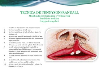 TECNICA DE TENNYSON/RANDALL
                                           Modificada por Hernández y Verdeja 1964
                                                     hendidura mediana
                                                     (colgajo triangular).

1.    El centro del filtrum a nivel de la línea mucocutanea
2.    Es el pico labial lateral del lado sano
3.    Es el pico labial lateral del lado de la fisura (igual a la
      distancia 1-2)
4.    Se coloca en el centro de la columnela a nivel de su base
5.    Se ubica en la pared lateral de la base de la columnela en
      el piso nasal sano
6.    Es simétrico desde el punto 5 (se obtiene llevando la
      distancia 4-5 a partir del punto 4, hacia el lado fisurado)
7.    Se mide la distancia 2-5 (igual a la longitud de la
      primencia labial lateral del lado sano) y le restamos la
      distancia 6-3 (igual la longitud de la prominencia labial
      lateral del lado enfermo)
8.    Es donde se inserta el ala nasal en el piso nasal del lado
      sano.
9.    Es simétrico de 8, se localiza donde se inserta el ala
      nasal deforme en el piso nasal de ese lado
10.   Se traza a partir de 9 en dirección medial y es igual a la
      distancia 8-5 a la 9-10.
 