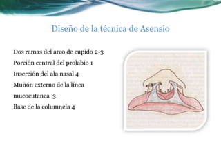 Diseño de la técnica de Asensio

Dos ramas del arco de cupido 2-3
Porción central del prolabio 1
Inserción del ala nasal 4
Muñón externo de la línea
mucocutanea 3
Base de la columnela 4
 