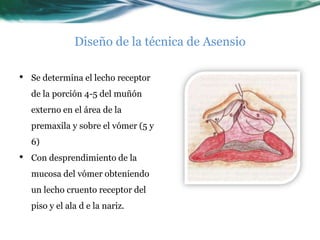 Diseño de la técnica de Asensio

•   Se determina el lecho receptor
    de la porción 4-5 del muñón
    externo en el área de la
    premaxila y sobre el vómer (5 y
    6)
•   Con desprendimiento de la
    mucosa del vómer obteniendo
    un lecho cruento receptor del
    piso y el ala d e la nariz.
 