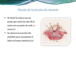 Diseño de la técnica de Asensio

•   Se inicia la sutura con un
    punto que unirá las alas de la
    nariz con un punto de seda 2
    ceros (1)
•   Se observa la tracción del
    prolabio para reconstruir el
    labio en forma simétrica (2)
 