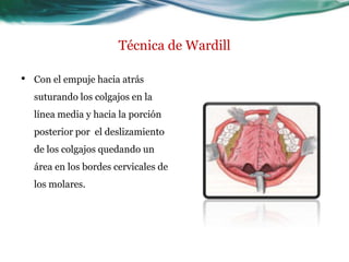 Técnica de Wardill

•   Con el empuje hacia atrás
    suturando los colgajos en la
    línea media y hacia la porción
    posterior por el deslizamiento
    de los colgajos quedando un
    área en los bordes cervicales de
    los molares.
 