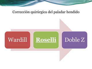 Corrección quirúrgica del paladar hendido




Wardill        Roselli          Doble Z
 