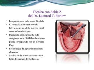 Técnica con doble Z
                        del Dr. Leonard T. Furlow
•   La aponeurosis palatina es dividida
•   El musculo puede ser elevado
    lateralmente desde la mucosa nasal
    con un elevador Freer.
•   Cuando la aponeurosis ha sido
    completamente dividida e l musculo
    puede ser separado con un elevador
    Freer
•   Los colgajos de Z plastia nasal son
    elevados.
•   Sus brazos laterales terminan en el
    labio del orificio de Eustaquio.
 