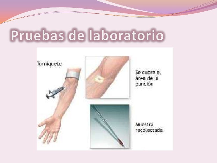 Tratamiento Odontologico En Pacientes Con Diabetes Mellitus Tratamiento Odontologico En Pacientes Con Diabetes Mellitus