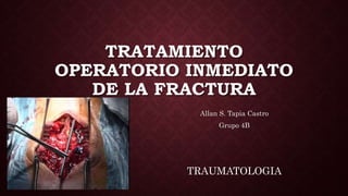 TRATAMIENTO
OPERATORIO INMEDIATO
DE LA FRACTURA
Allan S. Tapia Castro
Grupo 4B
TRAUMATOLOGIA
 