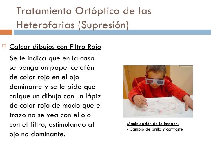 Ejercicios Ortopticos Para Hacer En Casa