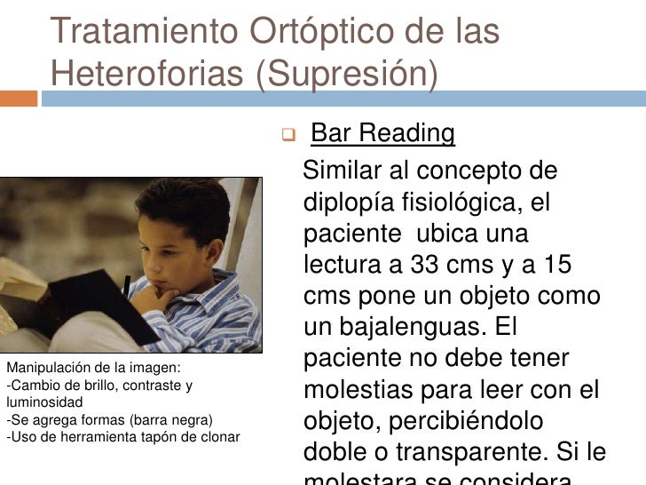 Ejercicios Ortopticos Para Hacer En Casa