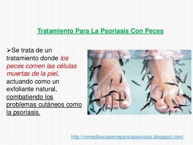La limpieza buena del organismo a la psoriasis
