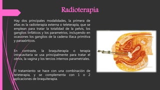 Hay dos principales modalidades, la primera de
ellas es la radioterapia externa o teleterapía, que se
emplean para tratar la totalidad de la pelvis, los
ganglios linfáticos y los parametrios, incluyendo en
ocasiones los ganglios de la cadena ilíaca primitiva
y paraaórticos.
Radioterapia
En contraste, la braquiterapia o terapia
intracavitaria se usa principalmente para tratar el
cérvix, la vagina y los tercios internos parametriales.
El tratamiento se hace con una combinación de
te!eterapia, y se complementa con 1 o 2
aplicaciones de braquiterapia.
 