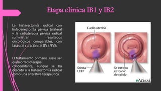 La histerectomÍa radical con
linfadenectomÍa pélvica bilateral
y la radioterapia pélvica radical
suministran resultados
oncológicos comparables, con
tasas de curación de 85 a 95%.
Etapa clínica IB1 y IB2
El tratamiento primario suele ser
quimiorradioterapia
concomitante, aunque se ha
descrito a la histerectomÍa radical
como una alterativa terapéutica.
 