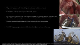 Pat Ricalde Tratamiento prequirurgico de labio y paladar hendido Felipe.pptx
