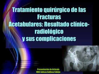Tratamiento quirúrgico de las
Fracturas
Acetabulares: Resultado clínicoradiológico
y sus complicaciones

Presentación de Artículo
MR3 Julissa Gallosa Fabián

 