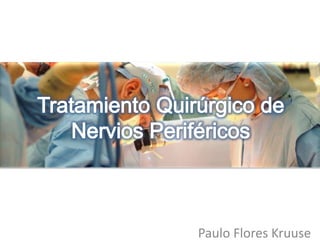 Tratamiento Quirúrgico de Nervios Periféricos Paulo Flores Kruuse 