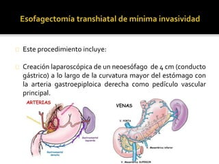 Este procedimiento incluye: 
Creación laparoscópica de un neoesófago de 4 cm (conducto 
gástrico) a lo largo de la curvatura mayor del estómago con 
la arteria gastroepiploica derecha como pedículo vascular 
principal. 
 