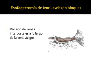 División de venas 
intercostales a lo largo 
de la vena ácigos. 
 