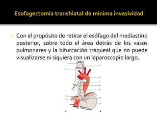 Con el propósito de retirar el esófago del mediastino 
posterior, sobre todo el área detrás de los vasos 
pulmonares y la bifurcación traqueal que no puede 
visualizarse ni siquiera con un laparoscopio largo. 
 