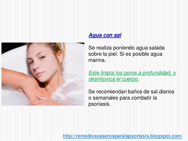 Las lociones y los ungüentos de la psoriasis
