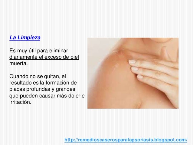 La psoriasis de la manifestación y los síntomas y el tratamiento