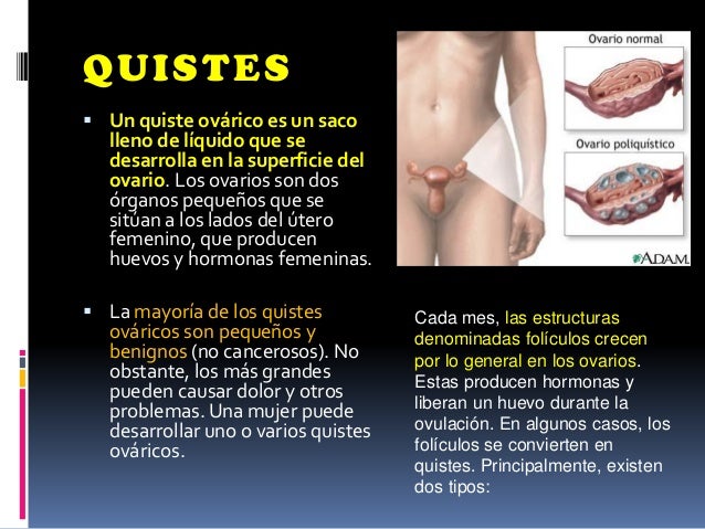 La osteocondrosis los baños de esencia de pino