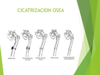 CICATRIZACION OSEA

 
