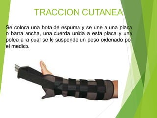 TRACCION CUTANEA
Se coloca una bota de espuma y se une a una placa
o barra ancha, una cuerda unida a esta placa y una
polea a la cual se le suspende un peso ordenado por
el medico.

 