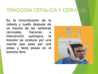 TRACCION CEFALICA Y CERVICAL.
Es la inmovilización de la
cabeza y cuello después de
un trauma de las vertebras
cervicales,
fracturas
o
intervención quirúrgica, la
tracción se produce por una
cuerda que pasa por una
polea y tiene pesas en el
extremo libre.

 